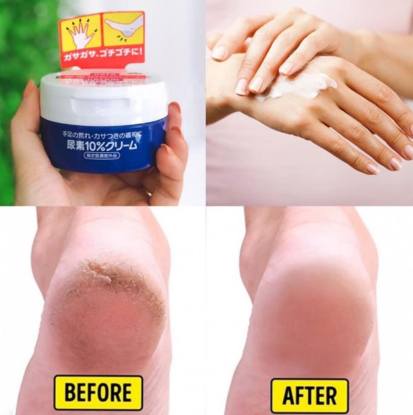 Kem trị nứt gót tay gót chân SHISEIDO