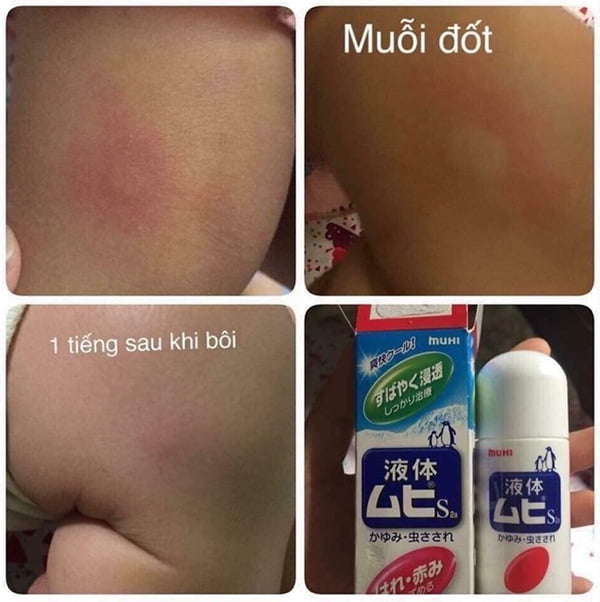 Lăn muỗi chim cánh cụt MUH