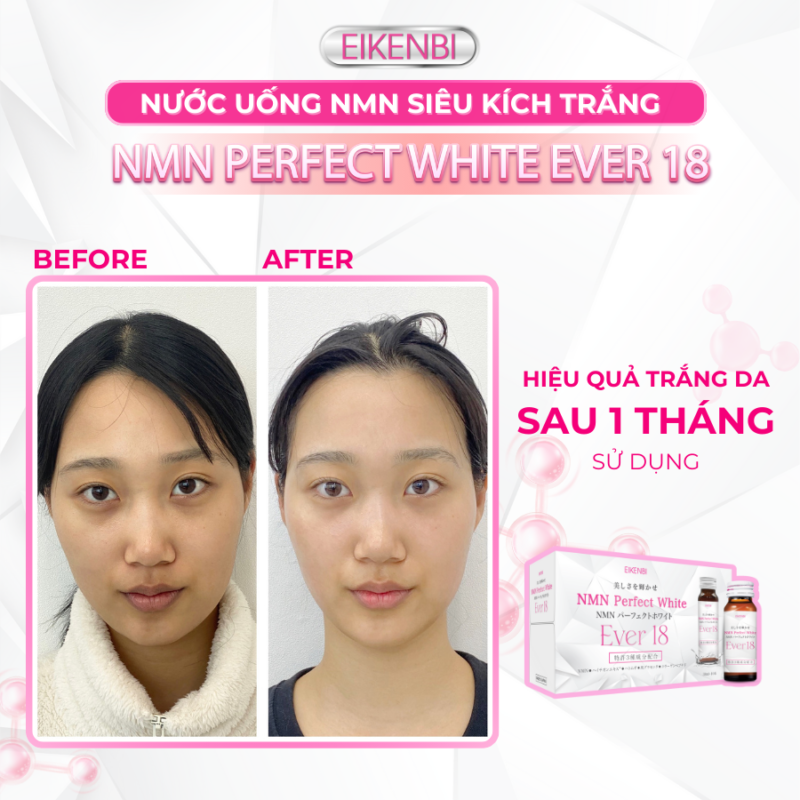 Nước uống kích trắng da NMN ever 10 lọ EIKENBI