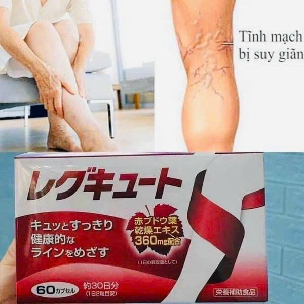 Viên uống điều trị suy giãn tĩnh mạch 60 viên MATSUMOTO